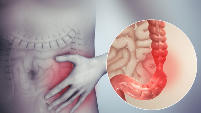 இர்ரிடபிள் பவல் சிண்ட்ரோம் (IBS): காரணங்கள், அறிகுறிகள் மற்றும் கட்டுப்படுத்தும் வழிமுறைகள்